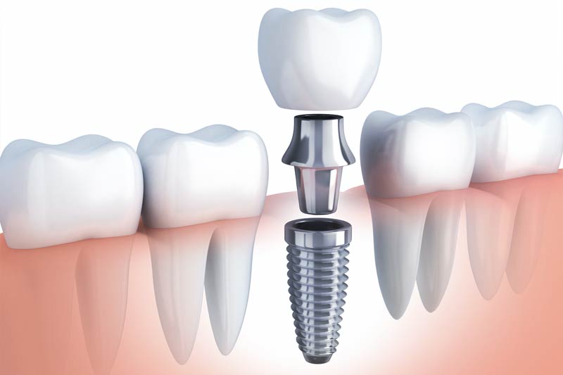 Dentist in Mission Viejo